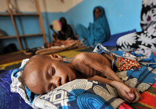 Article : La malnutrition, un phénomène dévastateur de la couche social tchadienne.